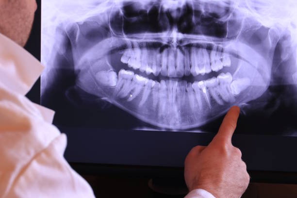 Best Emergency Root Canal Therapy in Cottonwood Shores, TX