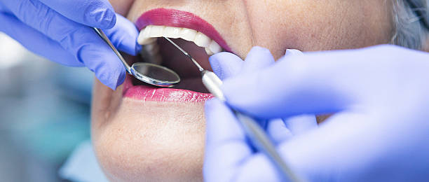 Best Emergency Care for Gum Disease in Cottonwood Shores, TX